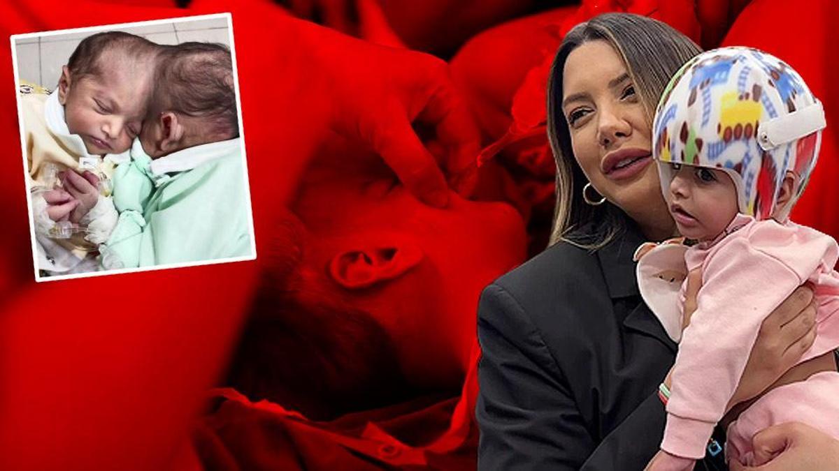 SON DAKİKA: Bu ameliyat Türkiye'de ilk kez yapıldı! | ÖZEL HABER - Sağlık haberleri