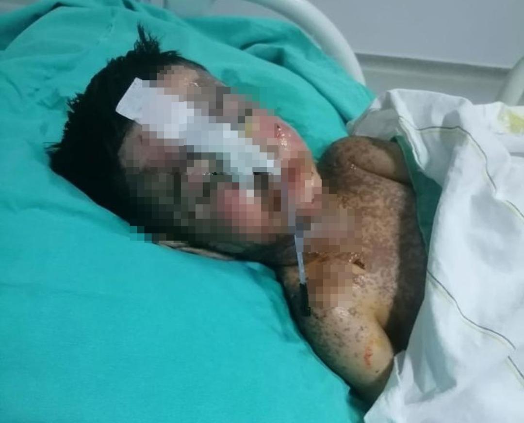 3 yıl sonra ortaya çıktı: 18 santimetre Catharers unuttu! Salatalık yutulduğunda ortaya çıktı 5